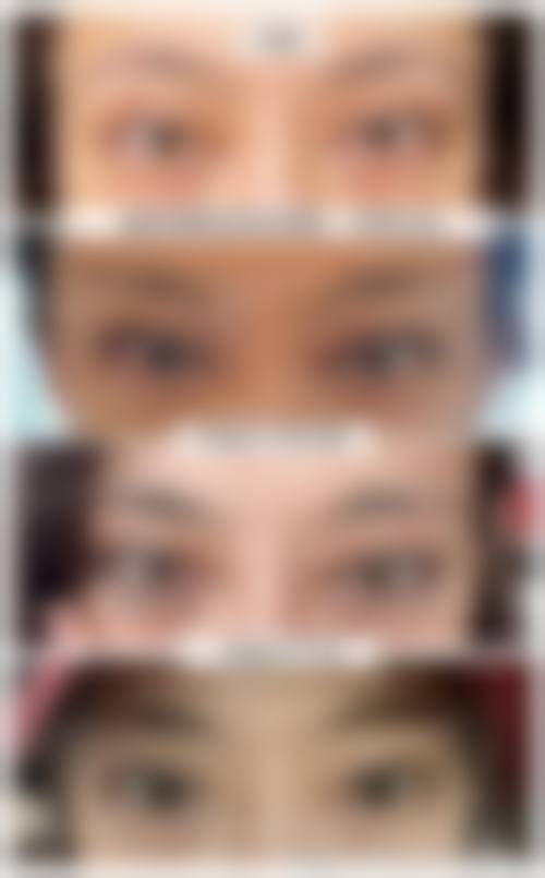 北京米兰柏羽丽都医疗美容医院面部抗衰套餐收费价格（2026 年）