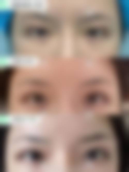 谢佳宪医生擅长项目