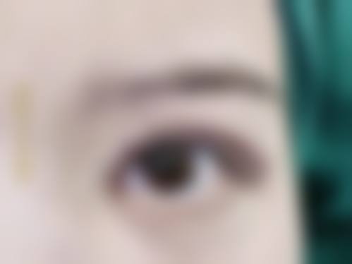 北京米兰柏羽丽都医疗美容医院面部抗衰套餐实例分享