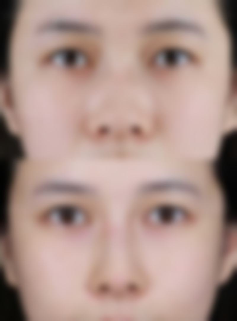 成都画美医疗美容医院黄元利医生预约挂号