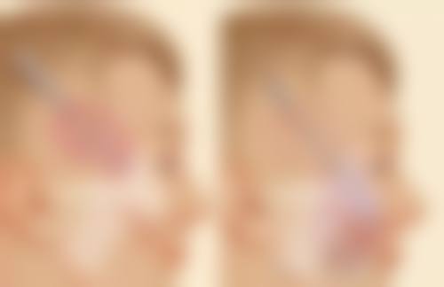 安康卓美医疗美容诊所价格参考