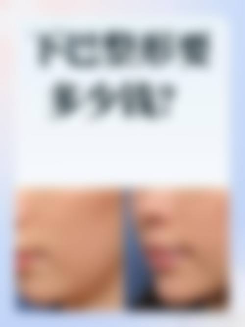 宁波米阳整形门诊部核心项目