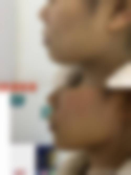 兴义容妍医疗美容医院患者评价