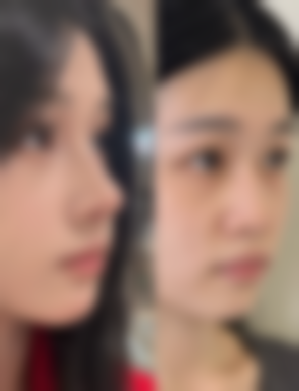 六盘水妍僖整形医院患者评价