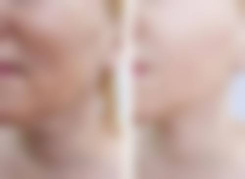 内蒙古赤峰柔本整形医院交通路线与预约