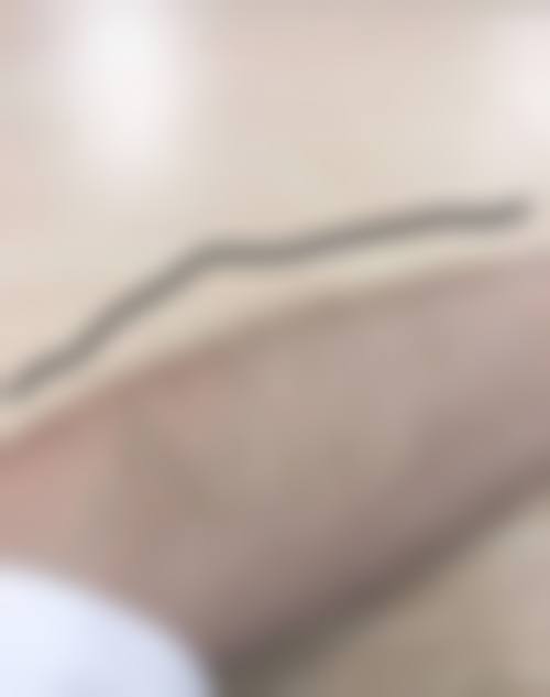 长春安卓儿整形医院价格参考