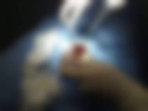 新疆五洲男科医院生殖整形科核心项目