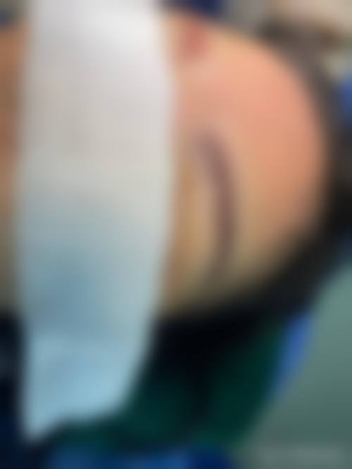 林大元患者评价