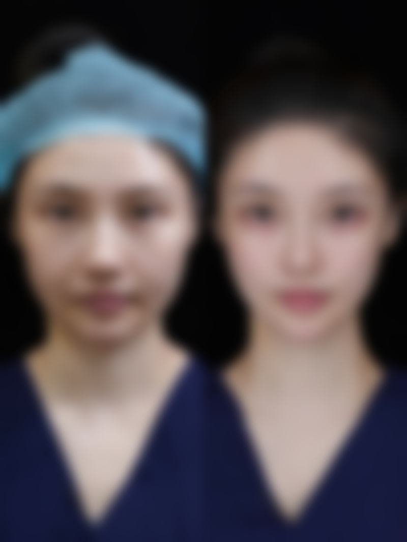 驻马店妍美医疗美容诊所价格参考