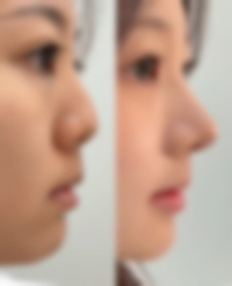 林大元擅长项目列表