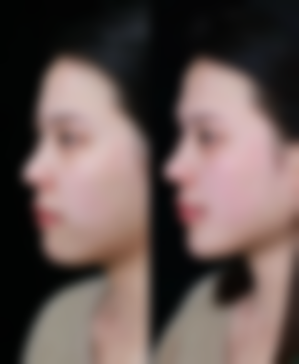 金泓锡预约方式