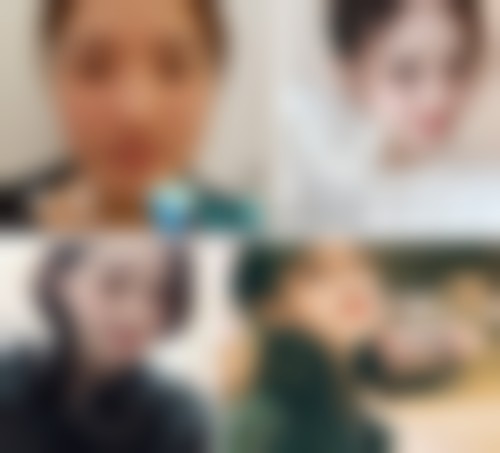 韩国纯真整形外科医院价格参考