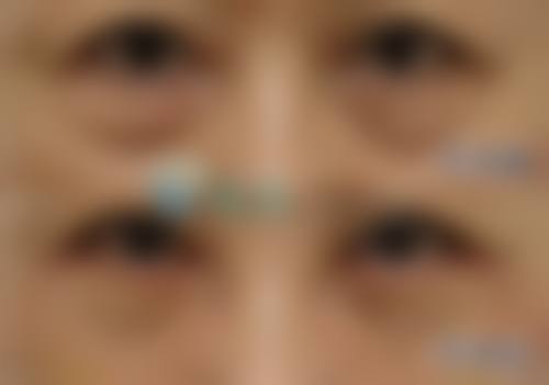 韩国纯真整形外科医院