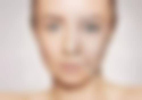 泉州兰森整形医院患者评价