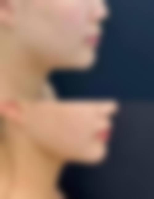 陈汉杰预约方式