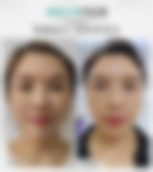 清潭YOON整形医院交通路线与预约