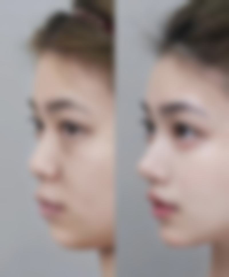 成都青羊雅媛整形医院患者评价