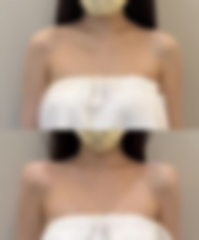 金泓锡预约方式