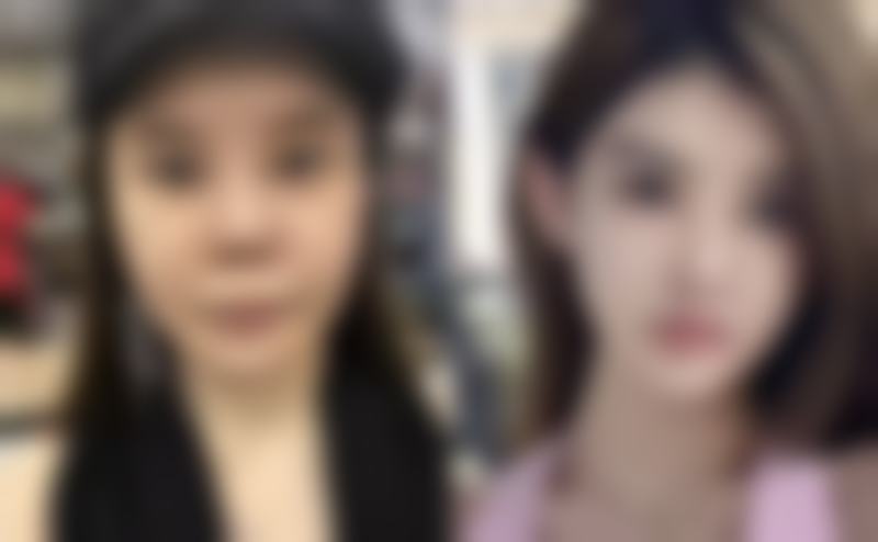 宣城华艺医学整形美容门诊部核心项目