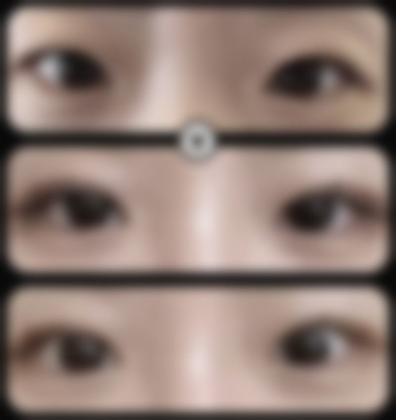 广西臻潼彦医疗美容医院价格参考