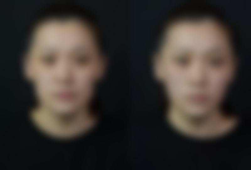 金泓锡患者评价