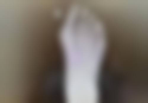 潢川县合润尤锋整形医院患者评价