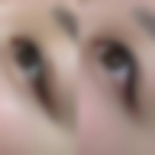 杭州芯美昕整形美容医院患者评价