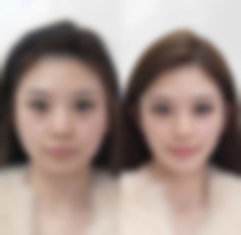 石家庄凤凰整形医院（私密美型医学中 心）患者评价