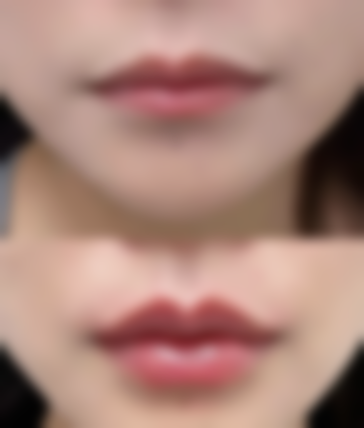 日照樱珂整形医院价格参考