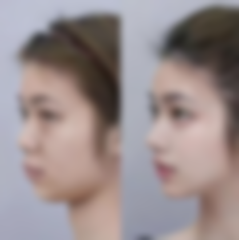 金炫澈技术水平评价