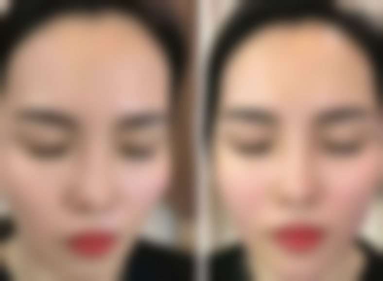 金东佑患者评价