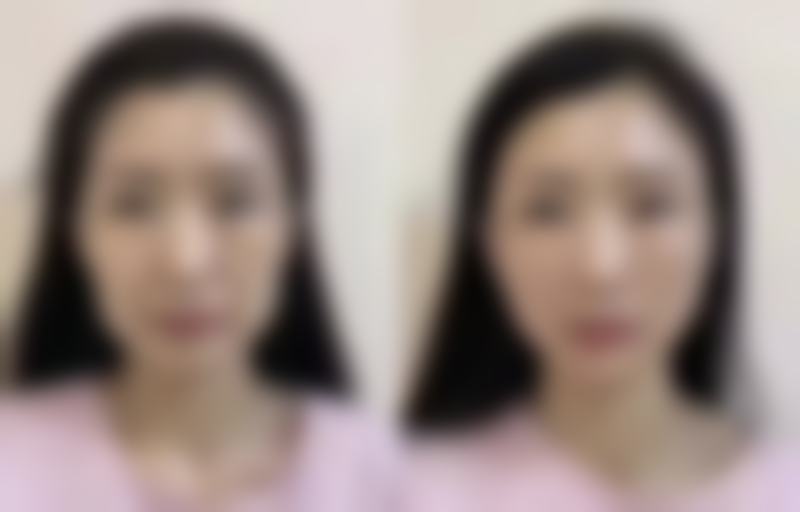 香港SWISSOBeautyExpert整形核心项目