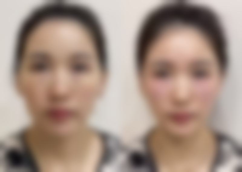 石家庄凤凰整形医院（私密美型医学中 心）核心项目