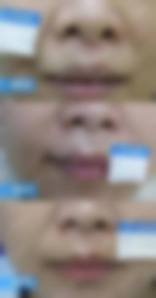 石家庄新兴中医皮肤病美容医院整形科患者评价