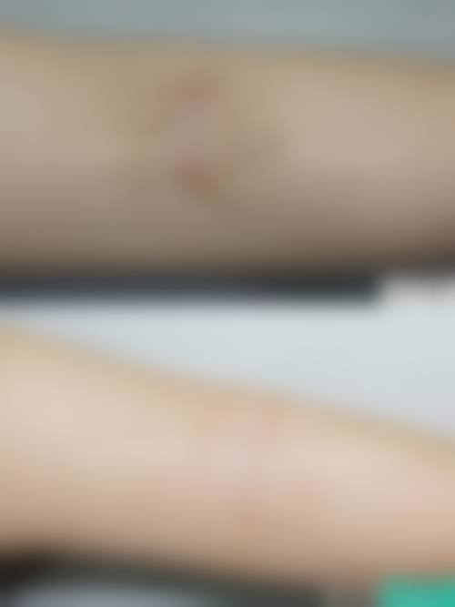 石家庄新兴中医皮肤病美容医院整形科价格参考