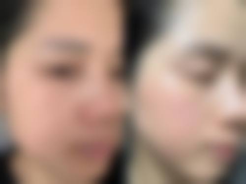 石家庄新兴中医皮肤病美容医院整形科核心项目