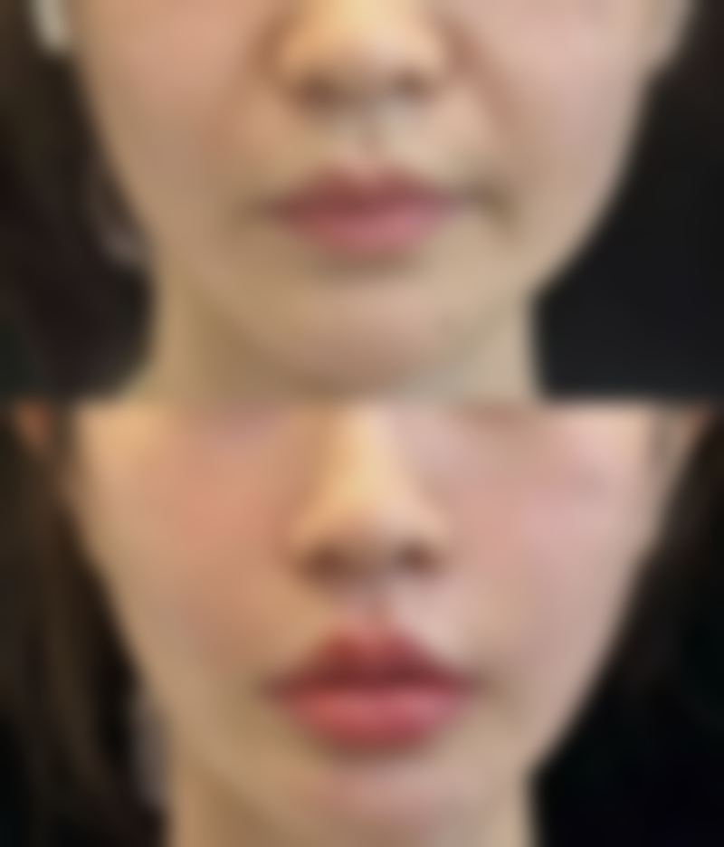 蓬江张红玛恩医疗美容诊所交通路线与预约