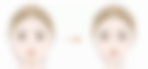 南京瑜雅医疗美容患者评价