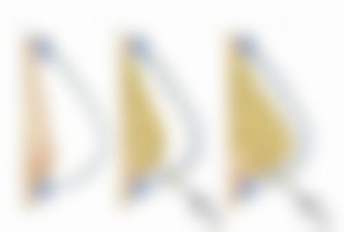 杭州理白整形医院患者评价