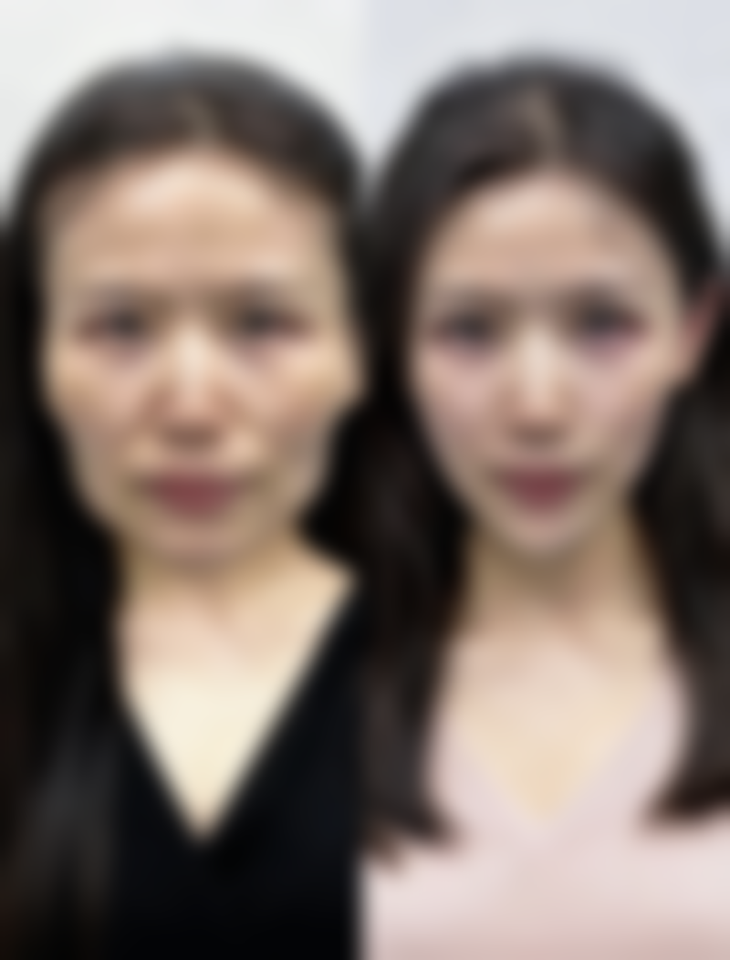 天津河东菲丝澜玺悦整形医院正规资质