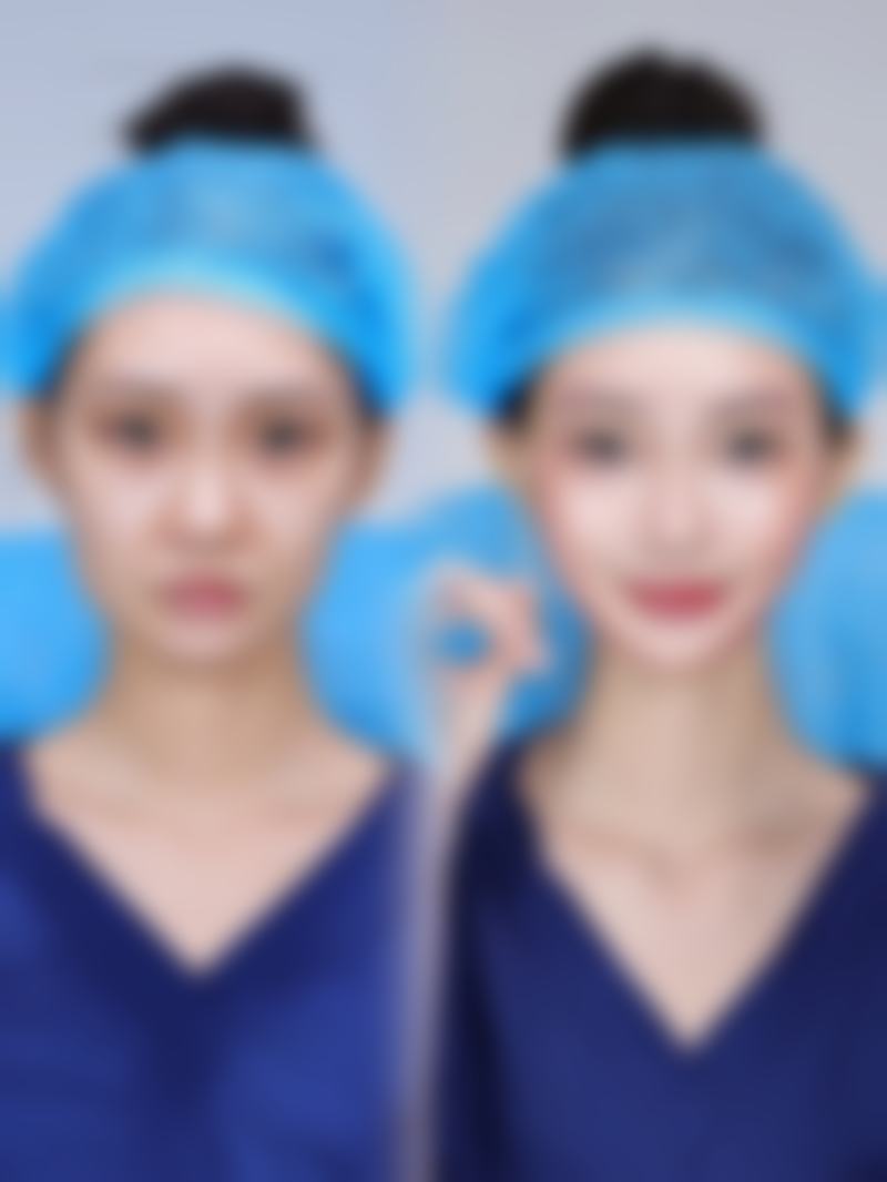 陈柳艺患者评价