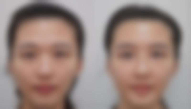 杭州蓓颜美整形医院正规资质