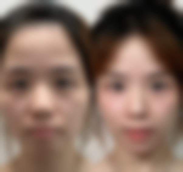 珠海永熙医疗美容医院价格参考