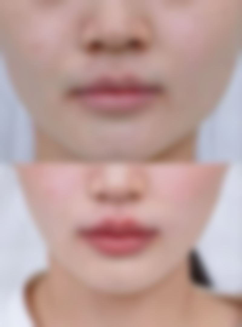 杭州理白整形医院价格参考