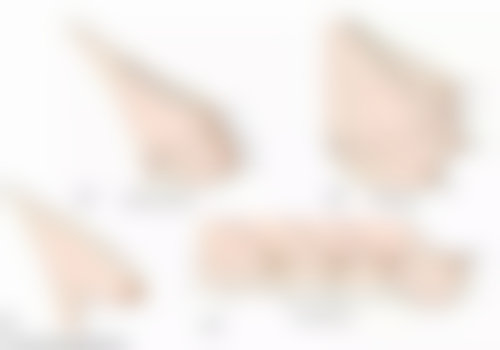 香港大学深圳医院整形科价格参考