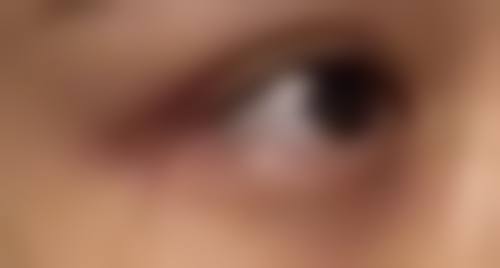 北京华意奕美整形患者评价