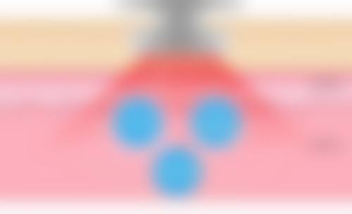 惠州漫芙整形医院核心项目