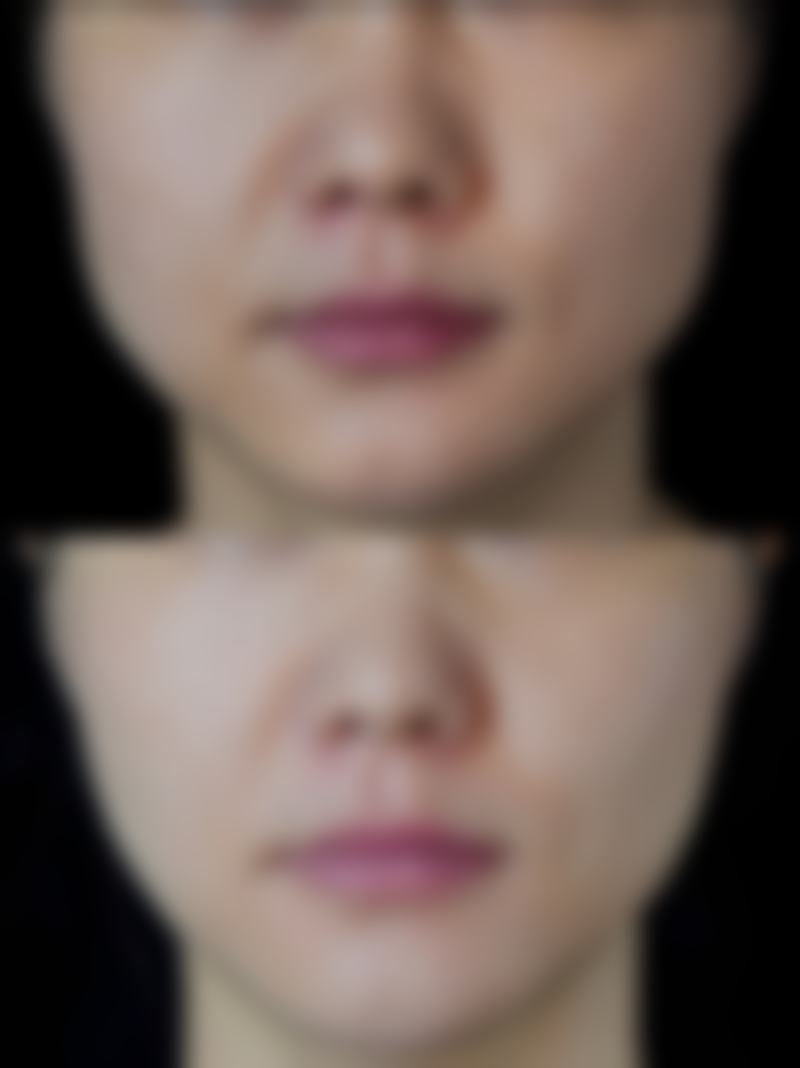 惠州漫芙整形医院正规资质