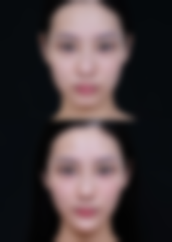 昆明韩辰整形医院交通路线与预约