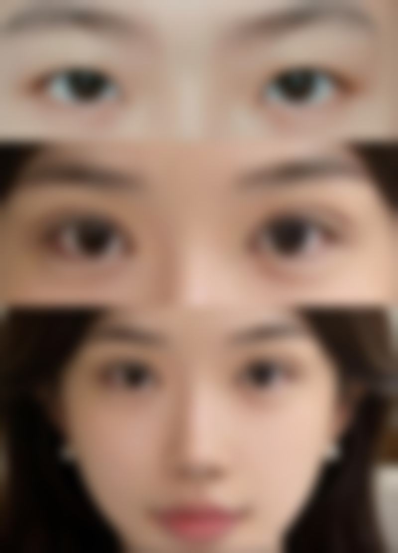 韩国美波皮肤科核心项目